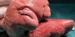 Şu ana kadar görülen 18'inci vaka...