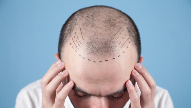 iStock-1297398866