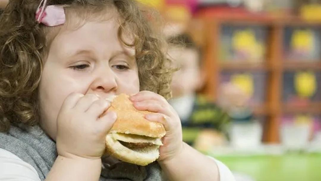 Ebeveynlerin dikkati! Obez çocuk sayısı, obez olmayan çocukların sayısını aştı 3