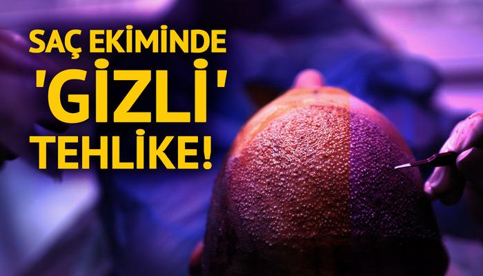 Saç ekiminde “gizli” tehlike!  “Gençlerde daha ölümcül ve sonuçları daha kötü”